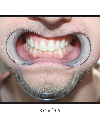 20 Piece Oral Dental Cheek Retractor